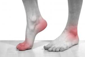 ăn hải sản có bị gout không